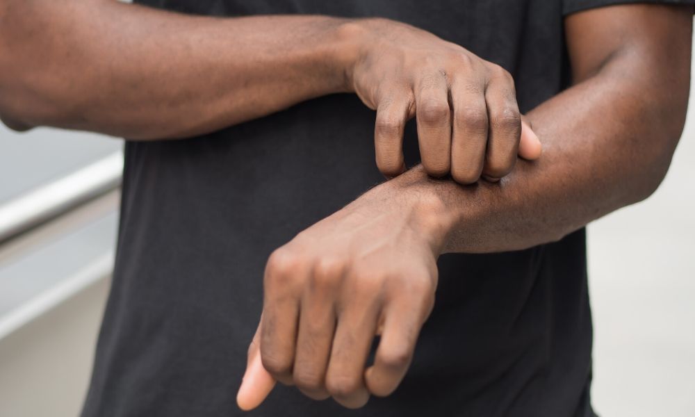 The Different Types of Eczema and How to Identify Them